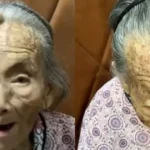 Idosa de 107 anos com chifre surpreende o mundo