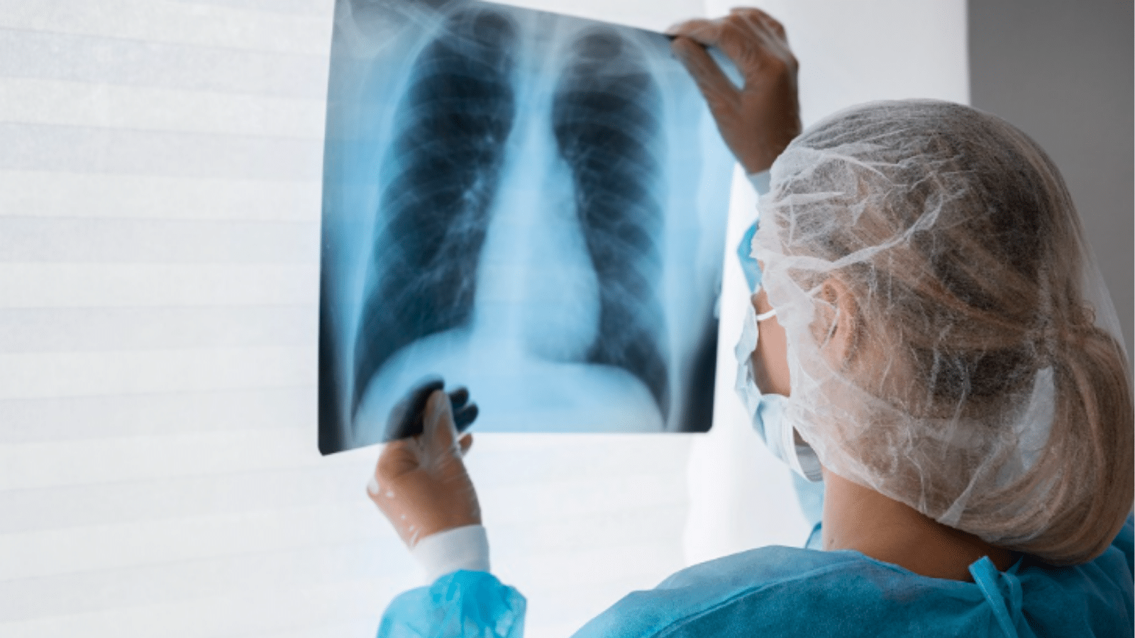 Tuberculose