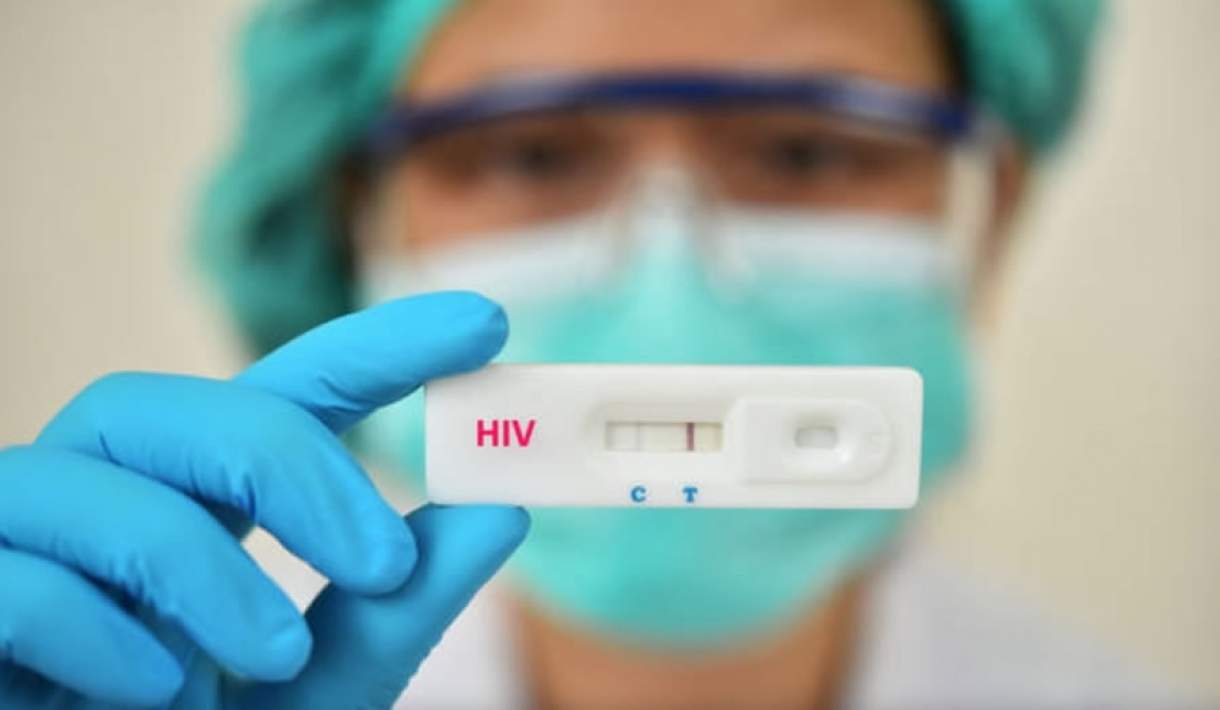HIV: a cura está mais próxima com resultados promissores