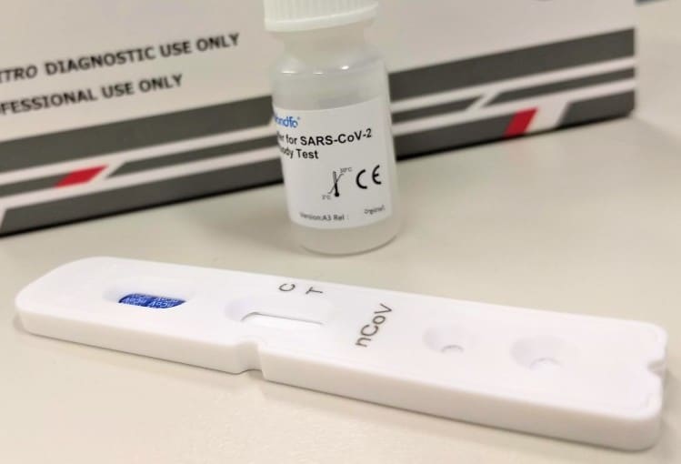 MP aponta superfaturamento em testes de Covid no RS