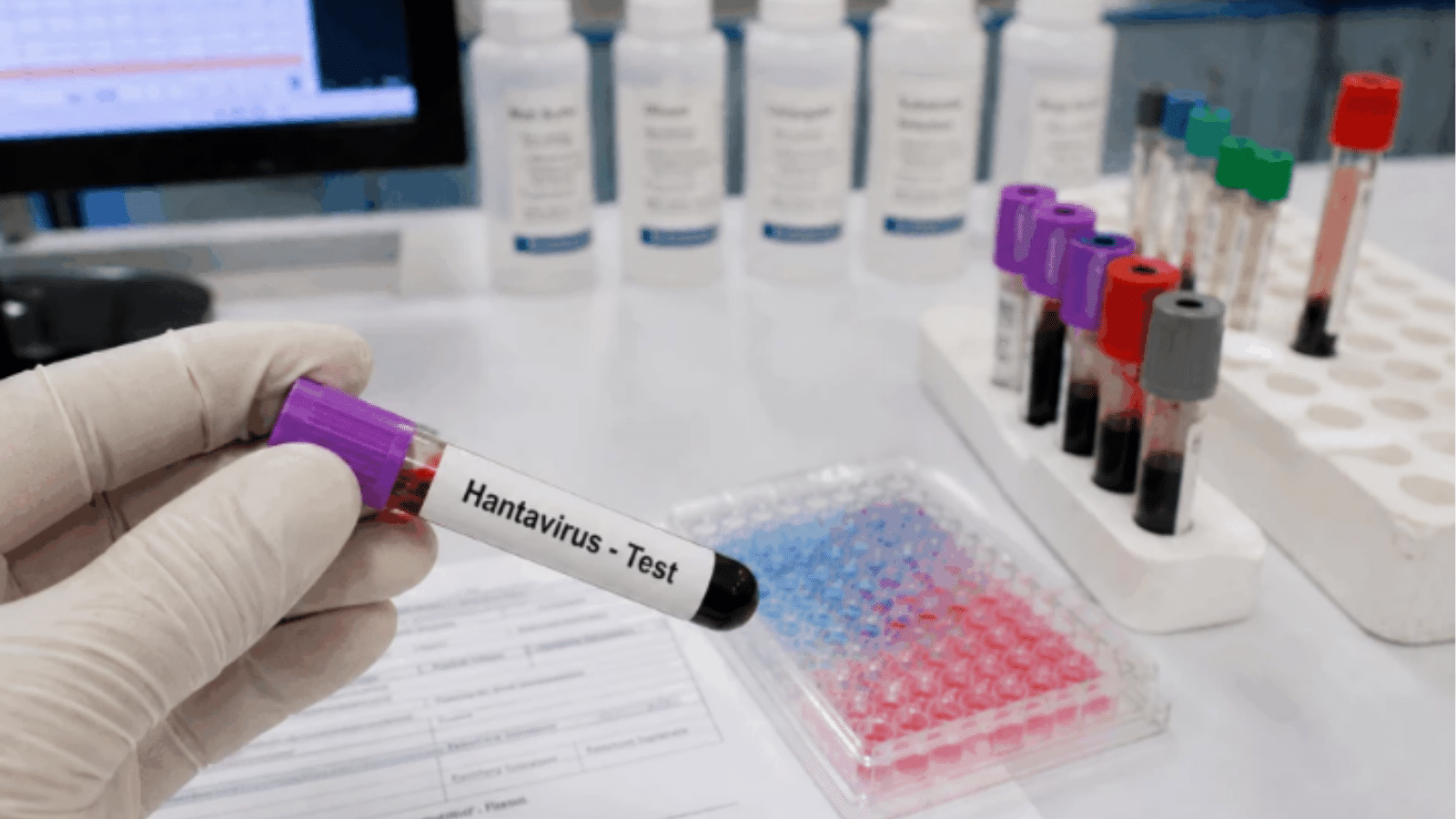 Infectologista esclarece que surto de hantavírus tem baixo risco de transmissão global