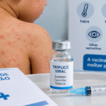 Sarampo preocupa autoridades e reforça alerta sobre vacinação no RS