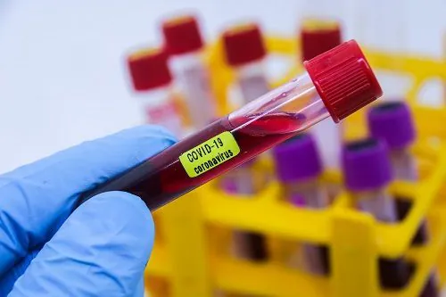 Brasil inicia neste mês testes de vacina contra o coronavírus